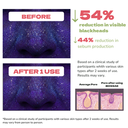 Holy Basil Bubble Pore Reset
