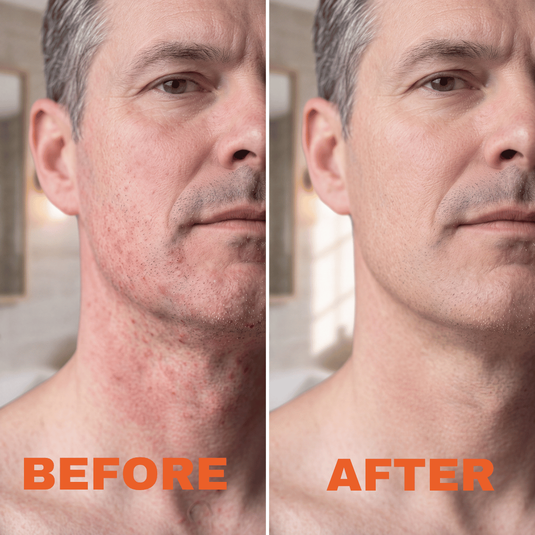 The Safety Razor Built Against Burn