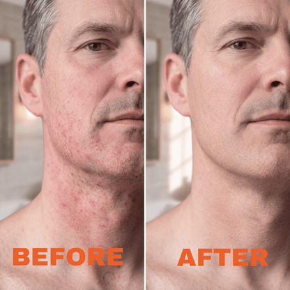 The Safety Razor Built Against Burn