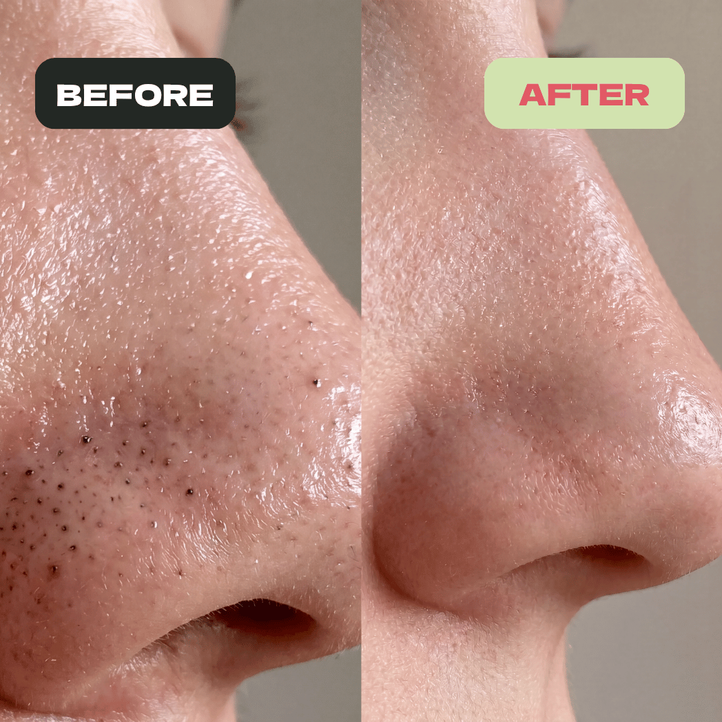 Holy Basil Bubble Pore Reset